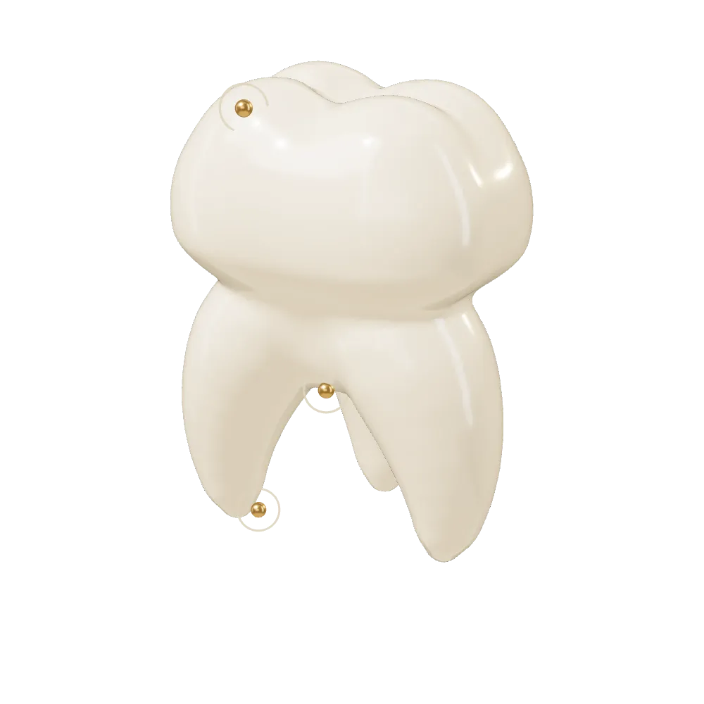 Molar 3D cu trei repere aurii, pe fundal petrol